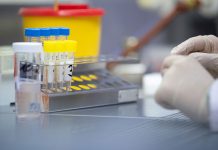 Очередной всплеск заболеваемости коронавирусом зафиксирован в Приднестровье Экспресс-тесты на выявление коронавируса апробировали в Приднестровье .Фото: rbc.ru