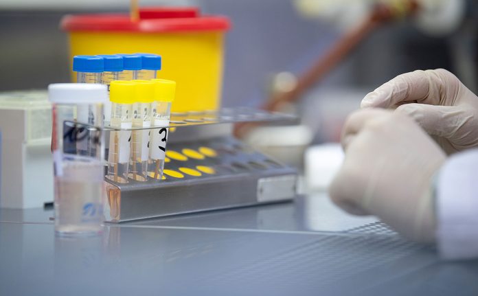 Экспресс-тесты на выявление коронавируса апробировали в Приднестровье .Фото: rbc.ru Экспресс-тесты на выявление коронавируса апробировали в Приднестровье .Фото: rbc.ru