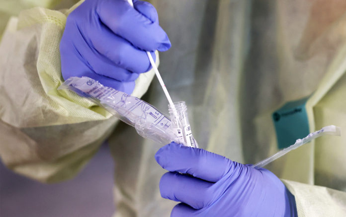 В Приднестровье поступили 5000 тестов на определение коронавируса