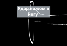 Удар ножом в ногу получил 22-летний рыбничанин от своей сожительницы Удар ножом в ногу