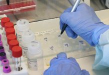 В психиатрической больнице села Выхватинцы провели экспресс-тестирование на COVID-19 Экспресс-тестирование в психиатрической больнице