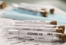 В Приднестровье с августа запущен механизм платного ПЦР-анализа В Приднестровье с августа запущен механизм платного ПЦР-анализа