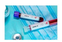 Только справка ПЦР-теста с мокрой печатью будет признаваться действительной Только справка ПЦР-теста с мокрой печатью будет признаваться действительной