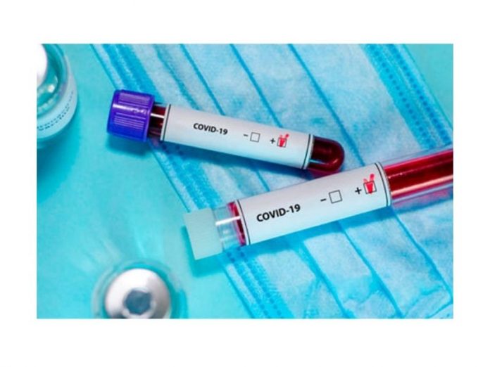 Только справка ПЦР-теста с мокрой печатью будет признаваться действительной