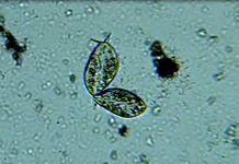 Теперь уровень загрязнения воды можно измерить смартфоном Фото newatlas.com