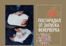 Фейерверк взорвался в руках у 29-летнего тираспольчанина