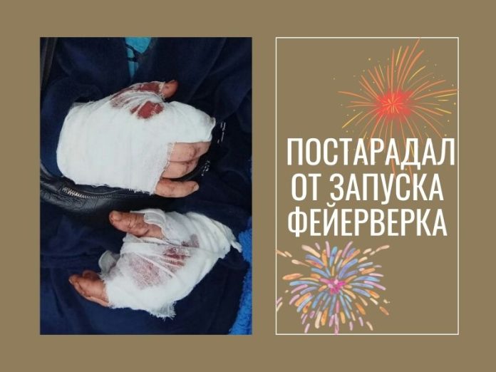 Пострадал от запуска фейерверка