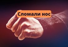 В Зозулянах мужчине сломали нос Сломали нос