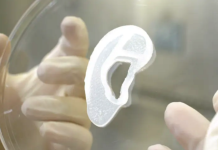 Пациенту пришили ухо, напечатанное на 3D-принтере пациенту, ухо, орган, пришили, медики