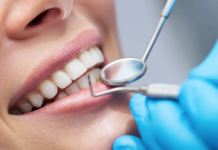 Как предупредить кариес стоматолог