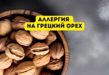 Аллергия на грецкие орехи Аллергия на грецкий орех