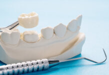 Льготное лечение зубов: акция для ветеранов и пенсионеров в Приднестровье стоматология, господдержка, Минздрав, льготы